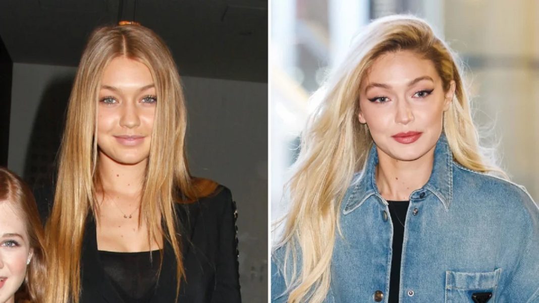 Gigi Hadid's Beauty Transformation: Has She Had Plastic Surgery?