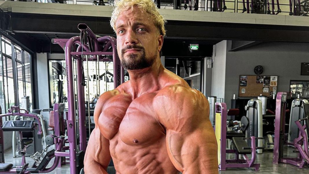 Jo Linder's Aneurysm: An Informed Report on His Cause of Death