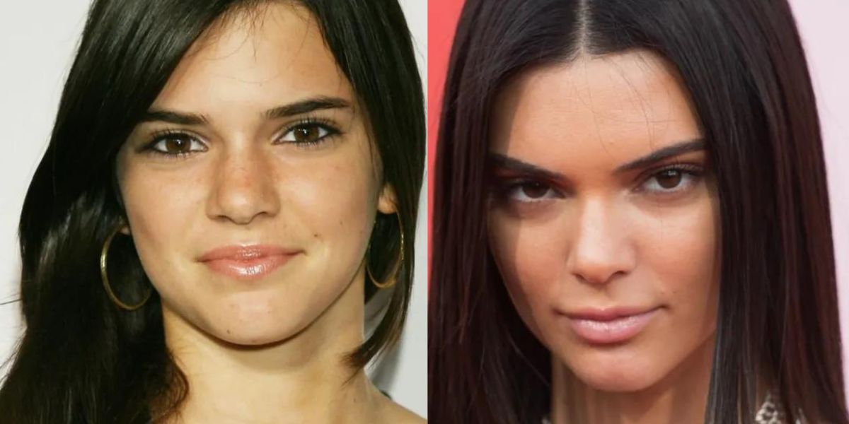 Kendall Jenner