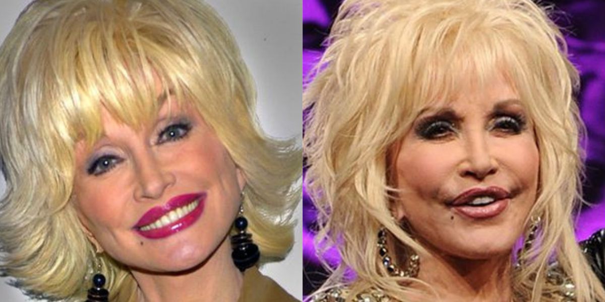 Dolly Parton