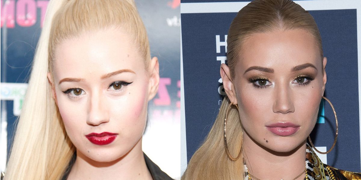 Iggy Azalea