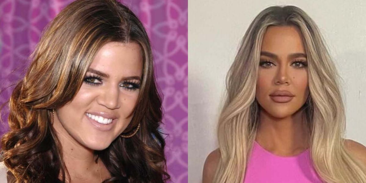 Khloe Kardashian